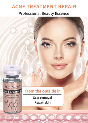 Bestes Produkt zur Behandlung von Gesichtsaknen Entfernen von Akne Glatte Haut und Schrumpfen von Poren Serum Aufhellen Aufhellen Essenz