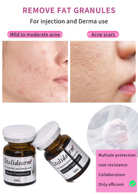 Fabriklieferungen Hautverstärker Pickel Reparatur Akne Behandlung Schwarzkopfentfernung Mesotherapie Serum Injektion OEM/ODM