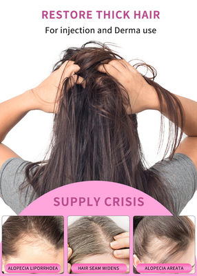 OEM Stalidearm Haarreparatur Serum Haarwachstum Anti Haarausfall Mesotherapie Serum Injektion 5 ml