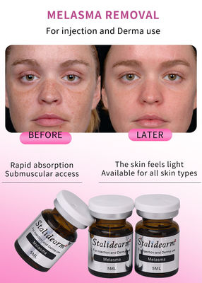 5 ml Anti-Melasma-Serum Flüssigkeits-Injektions-Set mit OEM-Anpassung