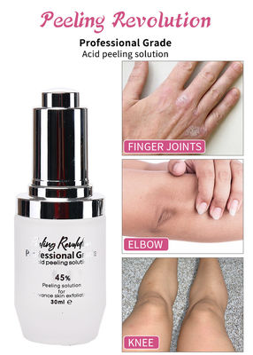 Professionelle Säure-Peeling-Lösung Flüssigkeit für die Gesichtspeeling