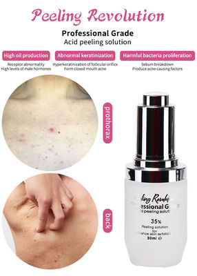 Professionelle Haut Exfoliation Serum Set Hautpflege Produkte Reinigung Wiederherstellung der Haut Revitalieren Exfoliating Lösung