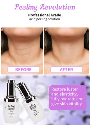 Professionelles Gesichtspeelingserum für Hautpeeling-Lösung