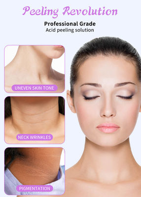 Professionelles Gesichtspeelingserum für Hautpeeling-Lösung