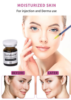 Stalidearm Hyaluronsäure Injektionsgesichtsserum für ultimative Hautverstärkung & Mesotherapie
