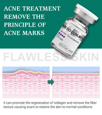 Reiner Betriebspickel-klares Serum, das Behandlung Mesotherapy für Akne-Narben weiß wird