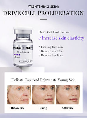 Alterndes Mesotransparente Mesotherapy Haut-anhebendes Antiserum serum Microneedling