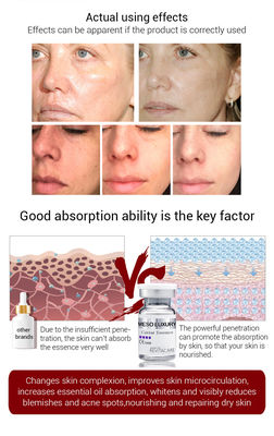 Erleichtern, Mesokaviar-Wesentlich-Serum serum Microneedling fest machend Mesotheraphy