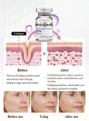 Mesozelle, die Energie-Serum-Antialtern Microneedling für das Haut-Weiß werden verjüngt
