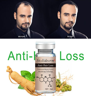 Antiserum-Betriebsbestandteil-natürliches Haar-Wachstums-Serum Microneedling des Haarausfall-10ml