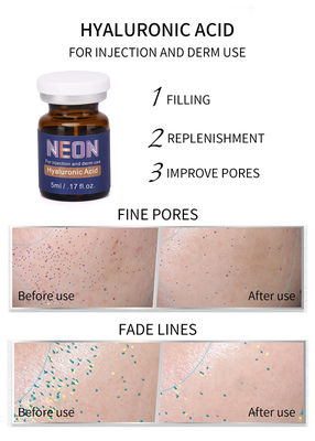 Weiß werden der Mesotherapie-Serum-Haut, die Einspritzungs-Antialtern der Hyaluronsäure-5ml erleichtert