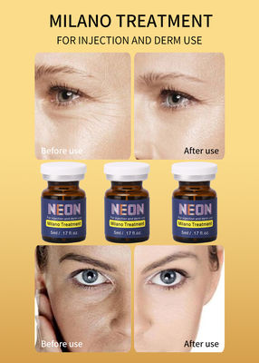 Melasma-Behandlungs-Serum der Mailand-Mesotherapie-Serum-Neonsommersprosse-schwarzen Flecke