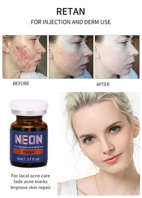 Neonmesoakne-Behandlungs-Serum-reines Wesentliches der therapie-Serum-Einspritzungs-5ml