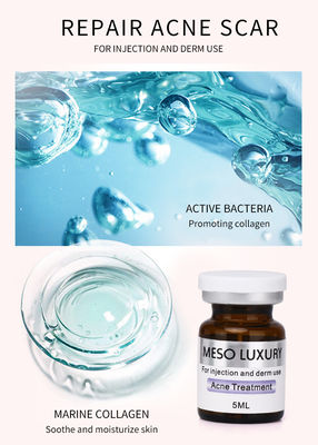 Rote Stellen Luxusjugend-Serum-Einspritzung Mesotherapy enthäuten Akne-Einspritzungs-Behandlung
