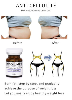 Mesoanticellulite-Serum, das verlierender Gewichts-Bauch-fettes brennendes Serum abnimmt