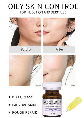 Peptid-Serum-Satz-Eigenmarke Soem des Öl-Steuer-Haut-Balancen-Serum-Meso- Luxus-Gold24k