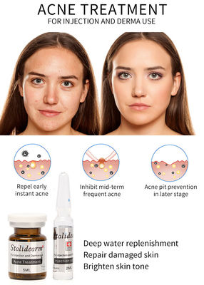 Exosomen Skin Booster Frankreich Original Stalidearm Akne Behandlung Injektions Serum Mesotherapie Lösung