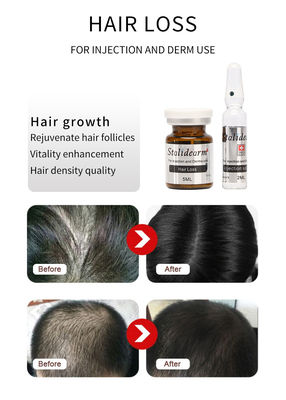 Injektierbares Haar-Exosomen-Serum France Original Stalidearm Haarwachstum Mesotherapie-Lösung