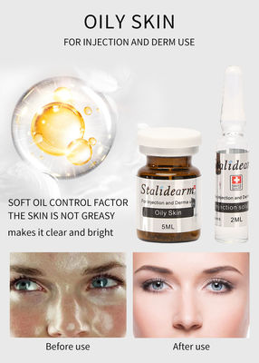 Ölige Jugend-Serum-Einspritzungs-Öl-Steuer-Mesotherapy-Haut-Behandlung