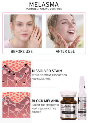 Melasma-Injektion Mesotherapie-Lösung Exosom Skin Booster Botox Dermal Filler