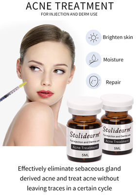 Akne-Behandlungs-Wesentlich-Serum-Einspritzung verwenden Meso-Theraphy, das sicheres gutes Effekt-Serum 5pcs/Set einstellte