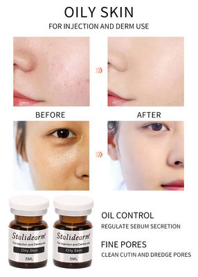 Einspritzungs-Serum für öliges sicheres gutes Effekt-Wesentliches der Haut-5ml/Bottle stellte ursprüngliche Stalidearm-Marke ein