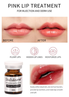 Großhandels-Marken-Rosa-Lippenbehandlungs-Einspritzungs-Serum-sicheres Wesentlich-Mesotherapie Stalidearm ursprüngliches stellte 5pcs/Set ein