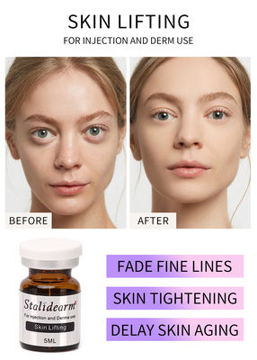 Der Haut-anhebender Einspritzungs-Serum-Einspritzungs-Haupthautpflege PRP Stalideram alternder natürlicher guter Antieffekt